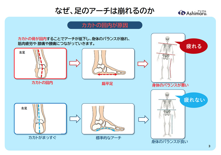 【なぜ足のアーチは崩れるのか】